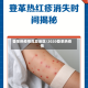 登革热疫情高发地区/2020登革热疫情