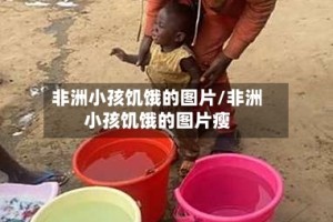 非洲小孩饥饿的图片/非洲小孩饥饿的图片瘦