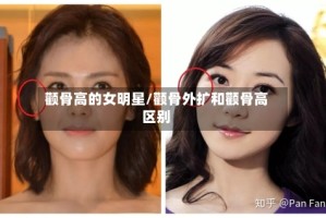 颧骨高的女明星/颧骨外扩和颧骨高区别