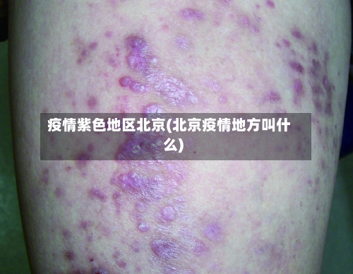 疫情紫色地区北京(北京疫情地方叫什么)-第1张图片